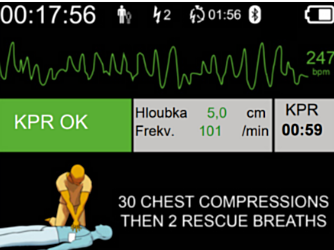DefiSign Pocket Plus pantalla ECG  - 11527